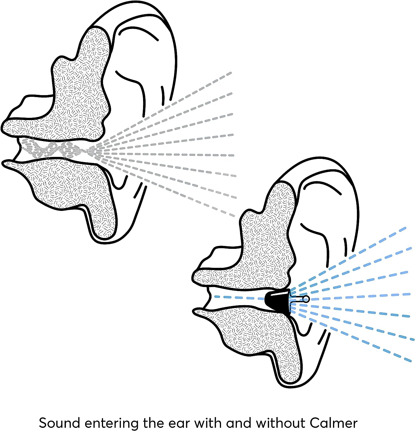 Calmer_Flare_ear_picture_